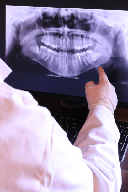 Best Emergency Root Canal Treatment in King, WI