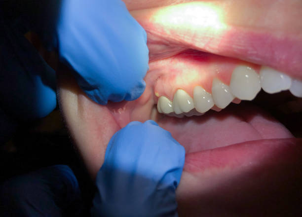 Best Cosmetic Emergency Dentistry in King, WI